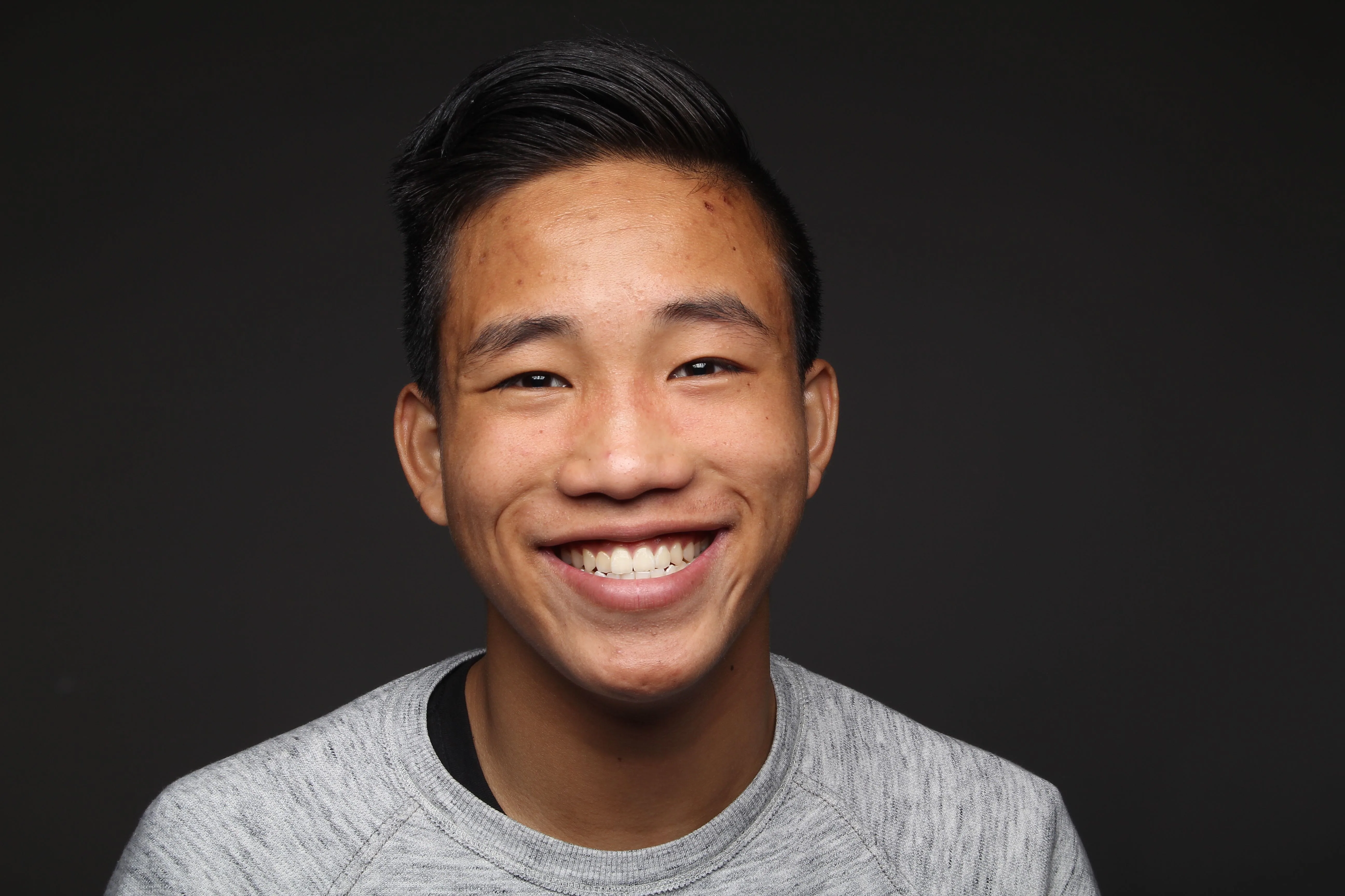 Smile inspiration—not patient cases