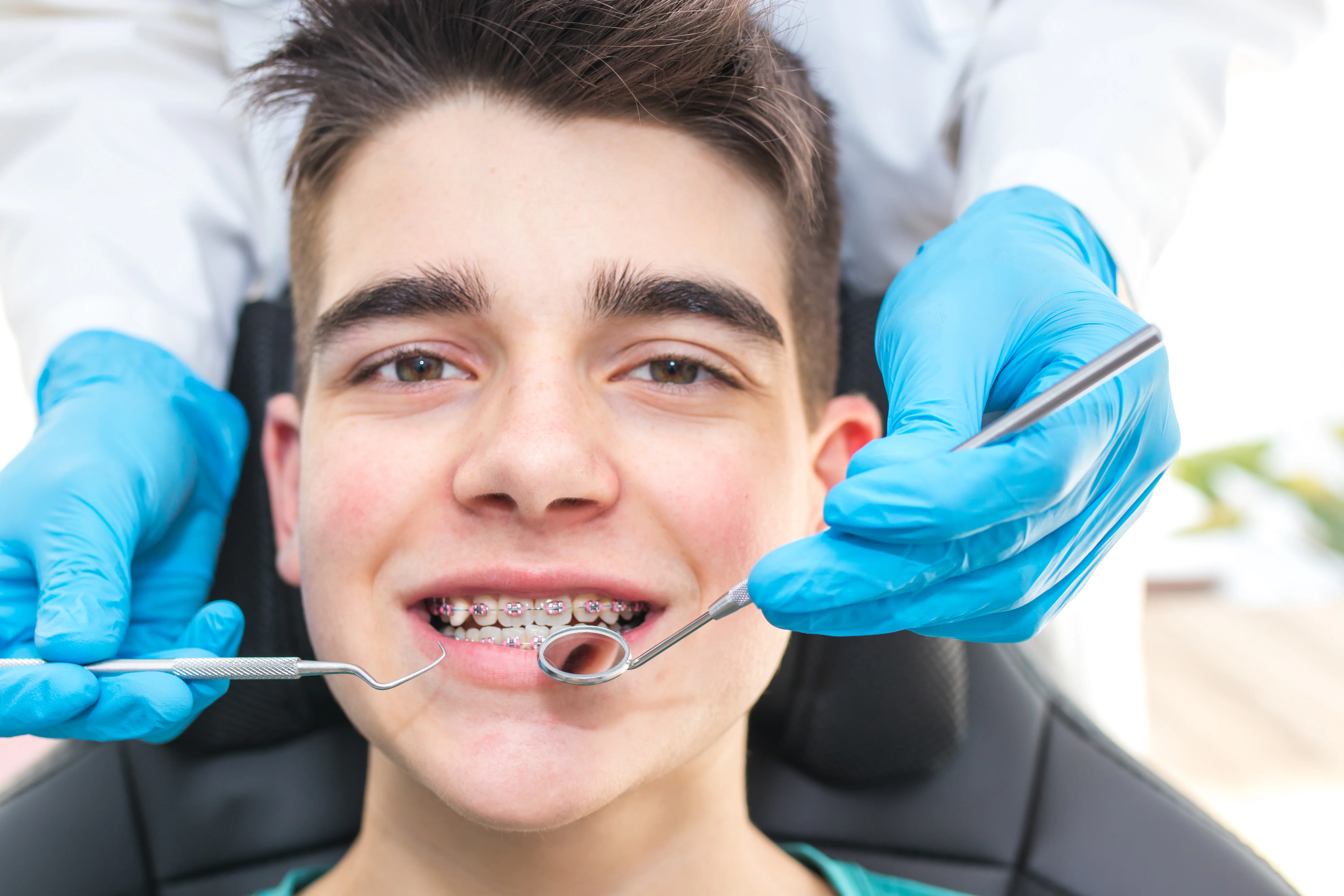 Traditional braces